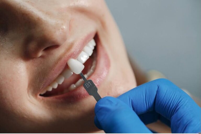 Dental Implants